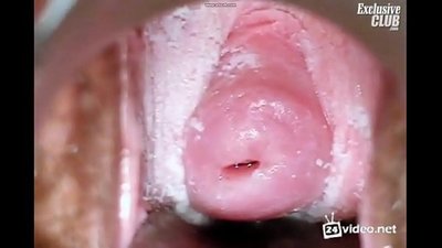 Gynekologické vyšetrenie krásnej ženy